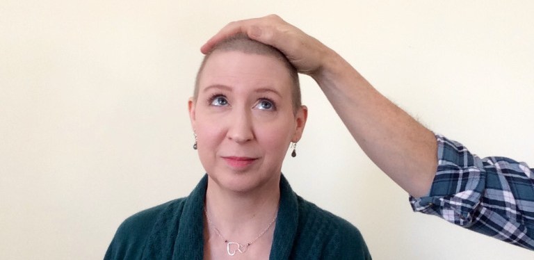 Of All The Hair I&nbsp;Lost…